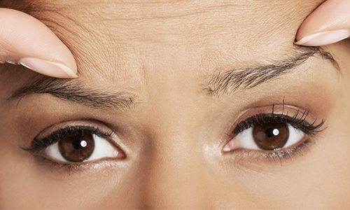 Double Eyelids: If You're Wondering Which Shape Will Suit You image 3