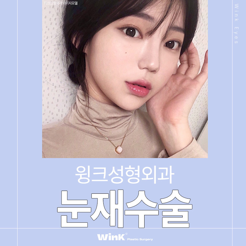 Looking for a place that does double eyelid revision surgery well? Wink Plastic Surgery eye revision surgery review image 1