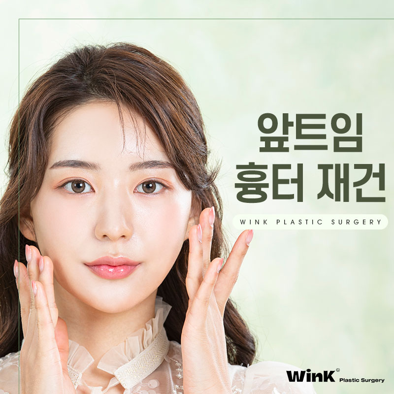 앞트임 흉 재건에 대해 알아보겠습니다. 관련 이미지 1