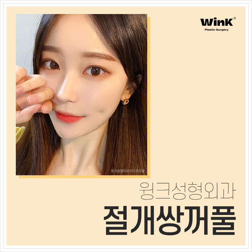 쌍수잘하는곳? 윙크성형외과 절개쌍꺼풀 쌍수절개붓기 관련 이미지 1