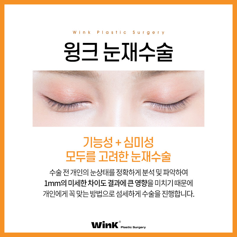 쌍꺼풀재수술 쌍수재수술후기 윙크성형외과 신사눈재수술비용 관련 이미지 5