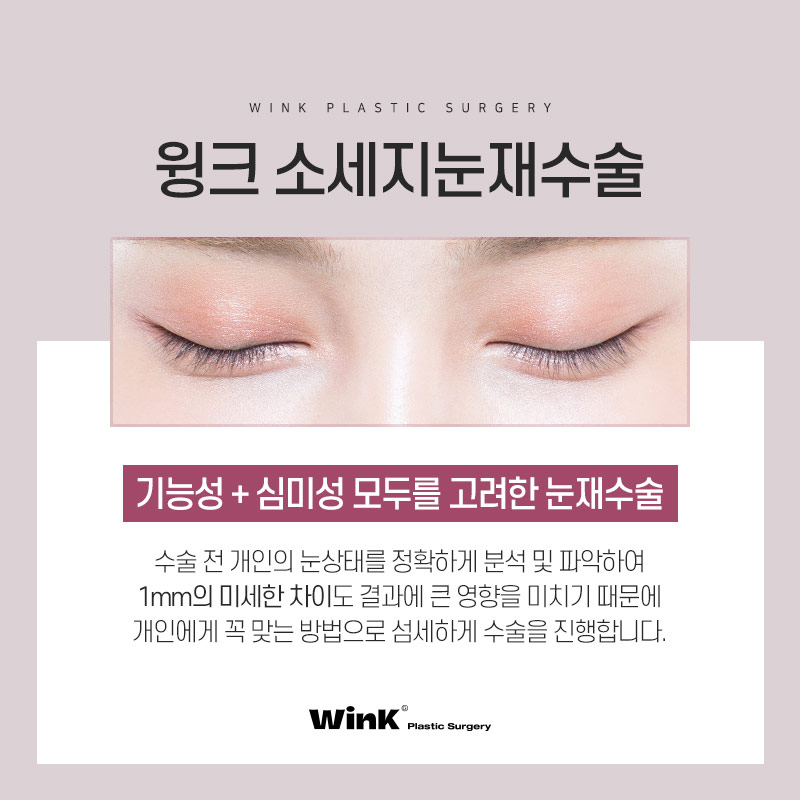 두껍고 높은 소세지눈? 윙크성형외과 두줄따기 눈재수술로 개선 관련 이미지 8