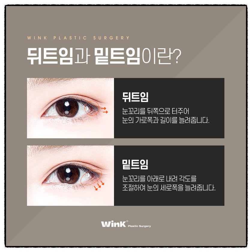 뒤트임부작용 뒤밑트임수술후기 트임잘하는곳 윙크성형외과 눈꼬리내리는수술 관련 이미지 4