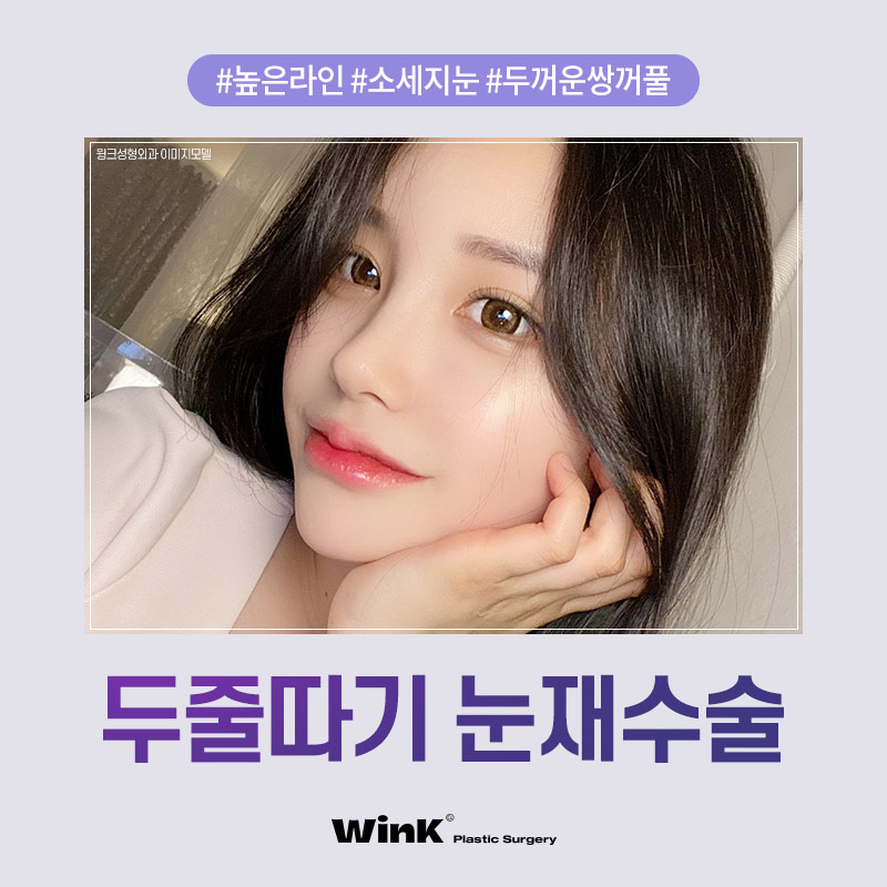 두껍고 높은 소세지눈? 윙크성형외과 두줄따기로 라인낮추기! 관련 이미지 1