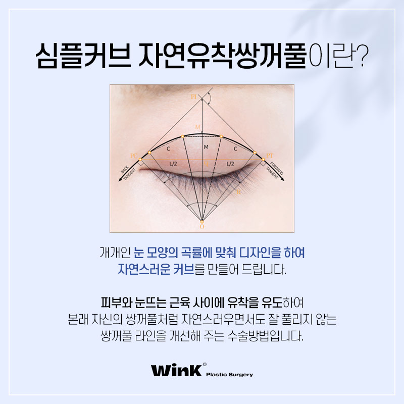 윙크성형외과 심플커브 자연유착 자연유착쌍꺼풀후기 자연스러운쌍수 쌍수자연유착 관련 이미지 2