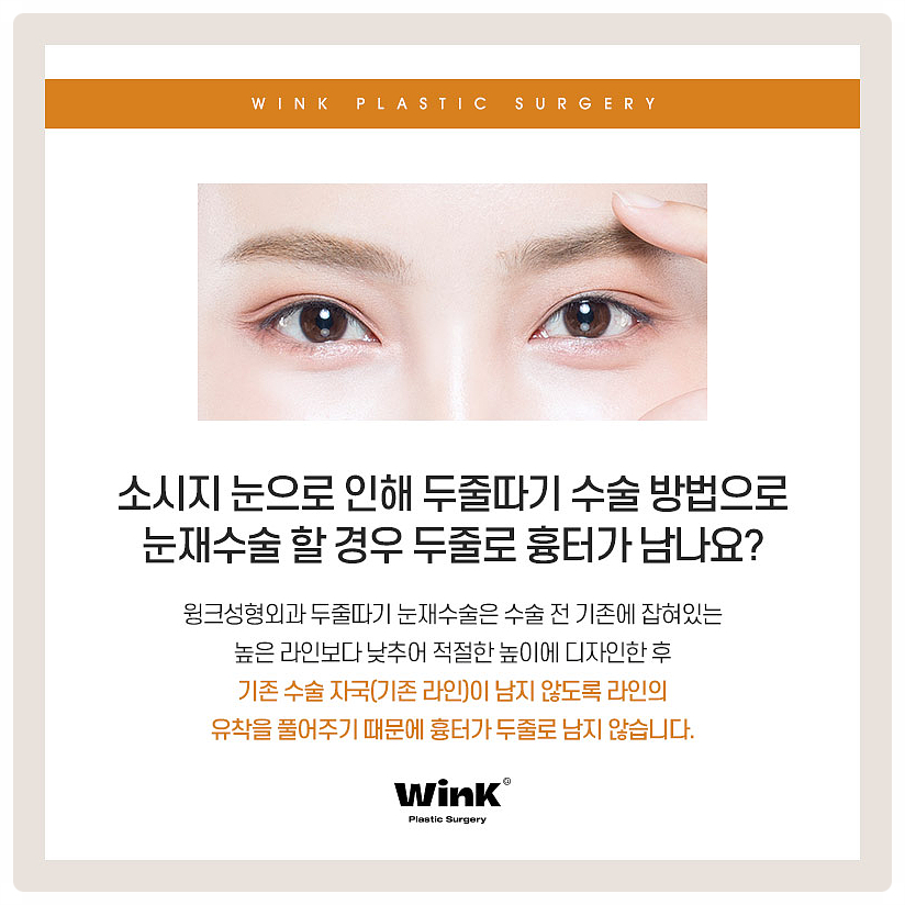 Double Eyelid Surgery Sausage Eyes, Double Eyelid Surgery Scars, Wink Plastic Surgery Double Eyelid Line Lowering, Sinsa Revision Eye Surgery Before and After image 6