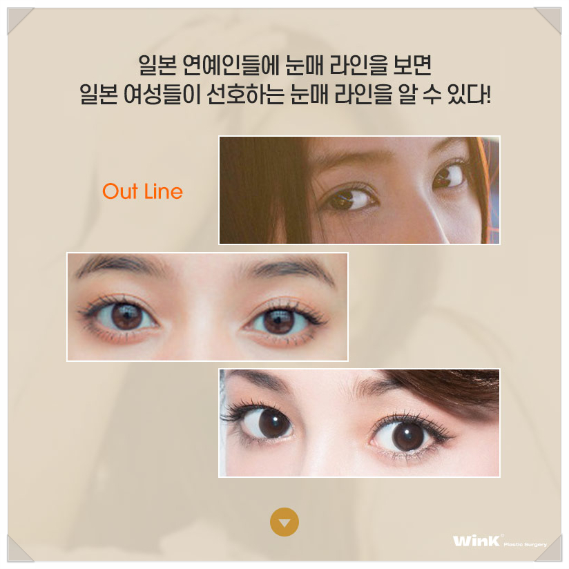 Japanese Double Eyelid Line? In-line Celebrity, Out-line Celebrity, and Wink Sinsa Natural Adhesion Double Eyelid Surgery image 4