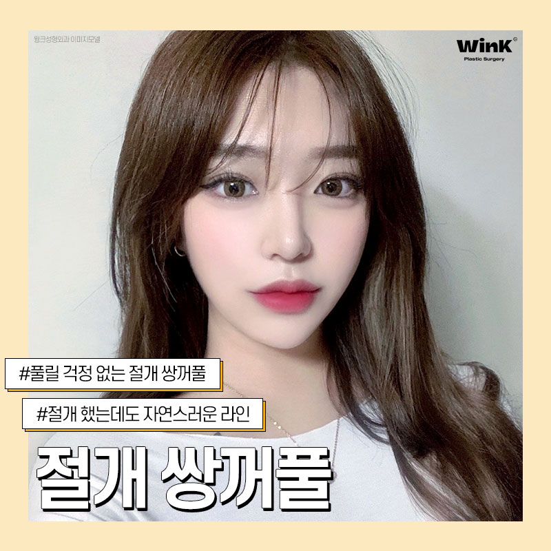 신사절개쌍꺼풀 쌍수절개후기 윙크성형외과 절개쌍꺼풀 관련 이미지 1