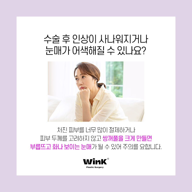 Improve Droopy Eyes with Wink Middle-Age Eyelid Surgery! image 5