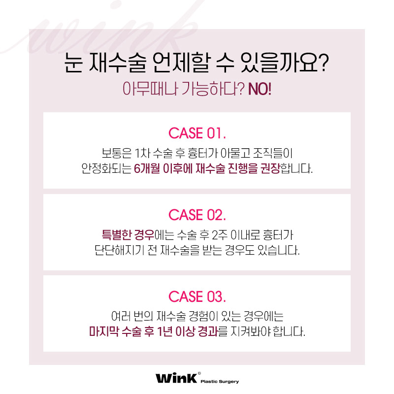 윙크 자연유착재수술로 자연스럽고 확실한 고정! 관련 이미지 6