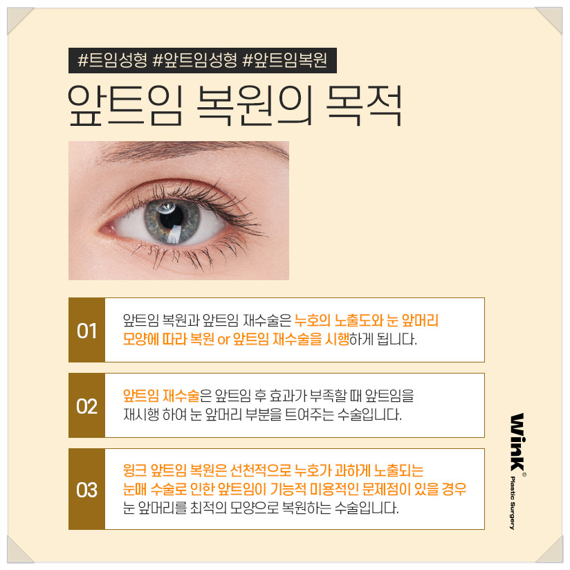 앞트임복원회복기간 앞트임복원후기 윙크성형외과 신사앞트임복원후기 앞트임부작용 관련 이미지 2