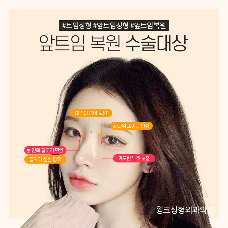 Let’s Learn About Epicanthoplasty Revision image 2