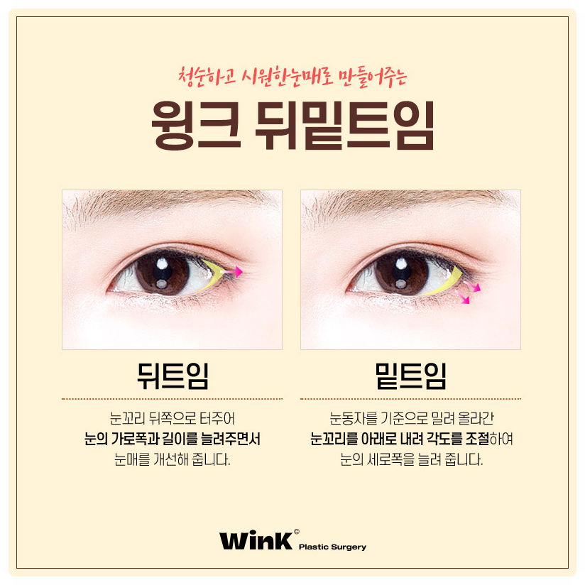 Inner and Lower Canthoplasty Price: Where to Get Canthoplasty Done Well — If You’re Curious About Inner and Lower Canthoplasty, Wink Plastic Surgery image 3