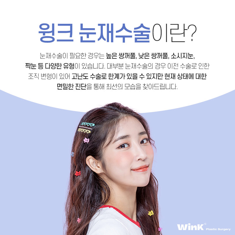 마지막 눈재수술을 위한 선택! 윙크성형외과 눈재수술 관련 이미지 2