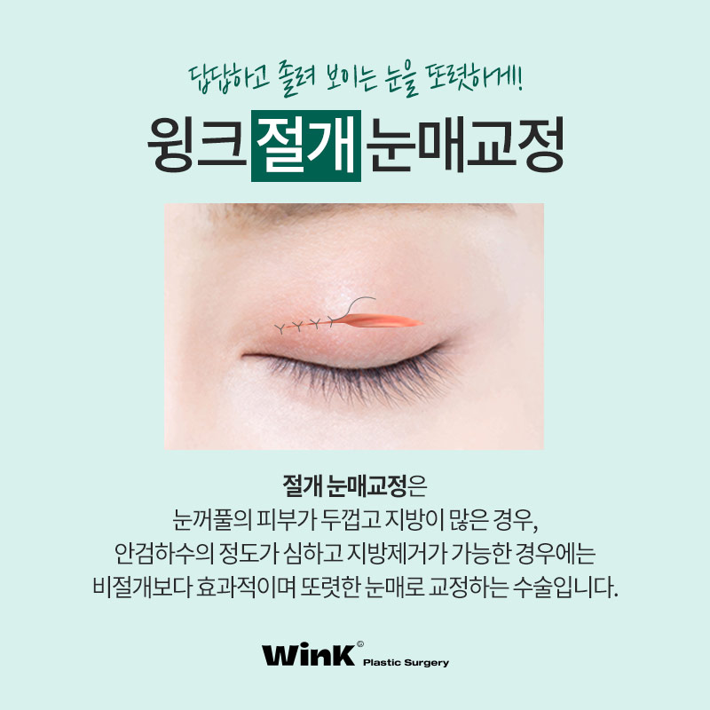 윙크성형외과 비절개 or 절개 눈매교정! 나에게 맞는 눈매교정은? 관련 이미지 6