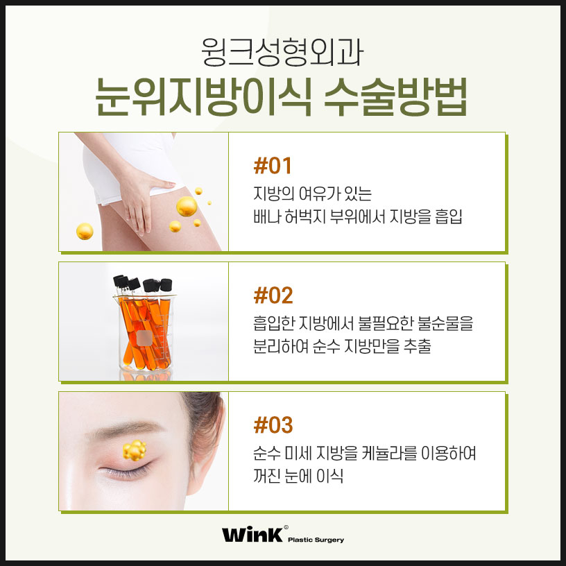 Sunken Upper-Eyelid Fat Graft Price | Wink Plastic Surgery | Eyelid Fat Grafting | Sunken Eyelid Surgery | Sinsa Upper-Eyelid Fat Graft Review image 5