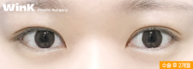 A Natural, Smooth Curved Line That Suits My Eyes! image 4