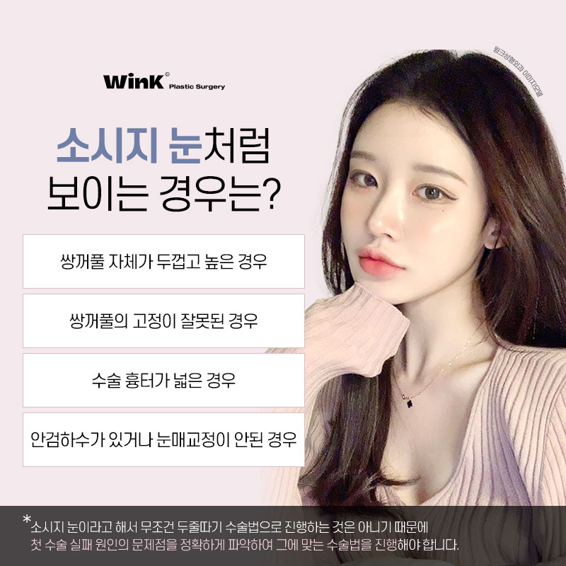 Thick, High Double Eyelid Lines and a Sausage-Like Eye! Solve It with Wink Double-Line Revision Surgery! image 3