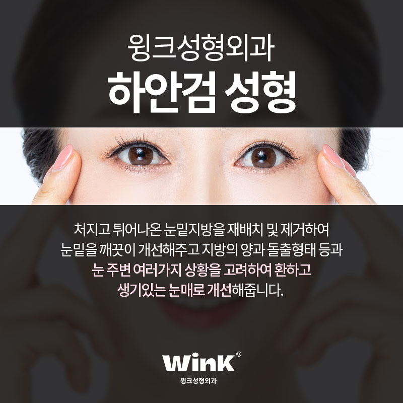 하안검 수술로 생기 있고 환한 동안 눈매로 관련 이미지 3