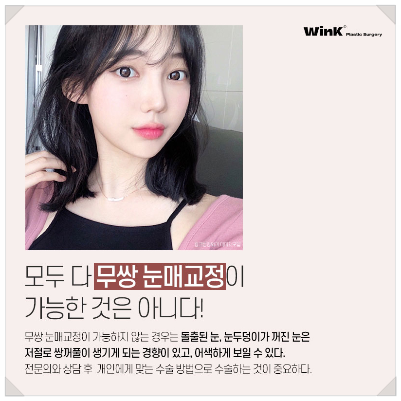 Epicanthoplasty-Free Ptosis Correction Surgery, Ptosis Surgery Without Double Eyelids, WINK Plastic Surgery, Ptosis Correction Surgery Before and After, Double Eyelid Ptosis Correction image 4