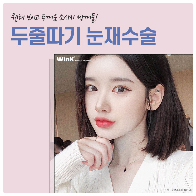 Revision Surgery for Sausage-Like Double Eyelids: Lowering the Double-Eyelid Line, Wink Plastic Surgery Sausage-Eye Revision Review image 1