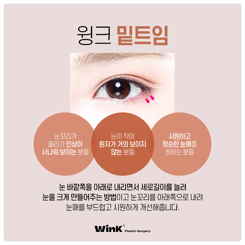Types of Eye Corner Surgery: Reviews of Epicanthoplasty, Upper Canthoplasty, Canthoplasty Before and After, Lower Canthoplasty Price, and Wink Plastic Surgery image 4