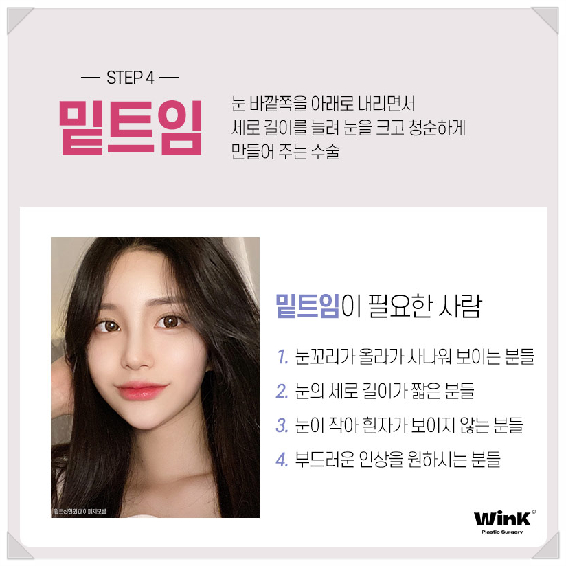 If You’re Looking Into Eye Widening Procedures: Wink Plastic Surgery’s Epicanthoplasty Price, Upper Canthoplasty Before and After, Rear Canthoplasty Reviews, and Where to Get Lower Canthoplasty Well Done image 6