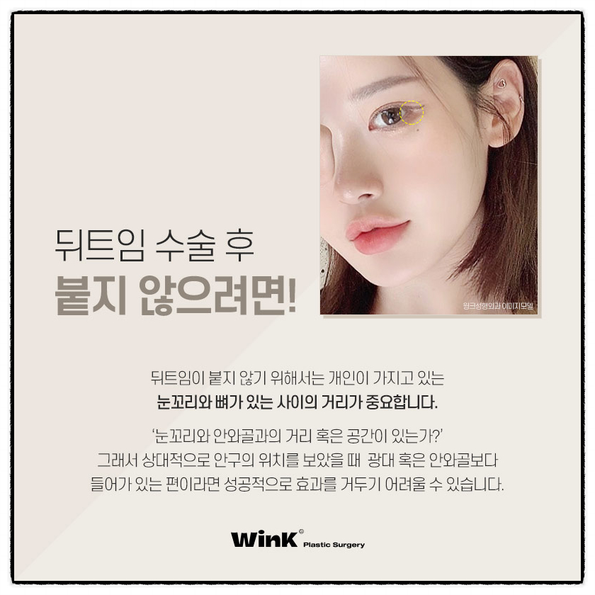 뒤트임부작용 뒤밑트임수술후기 트임잘하는곳 윙크성형외과 눈꼬리내리는수술 관련 이미지 3