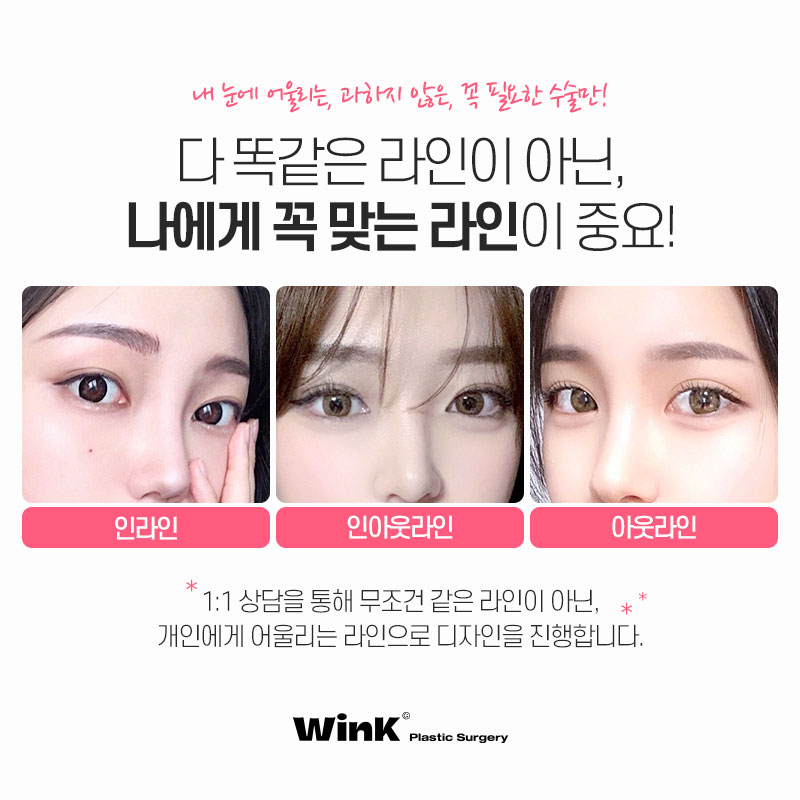 원래 내  눈 같은 자연스러움  윙크성형외과 자연유착 관련 이미지 6