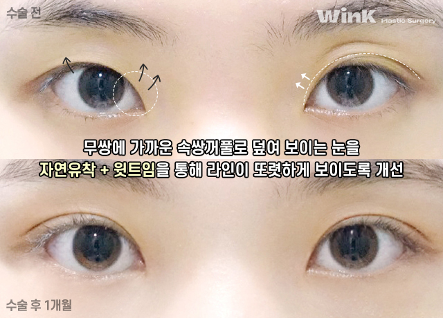 윙크 윗트임으로 날카로운 눈매를 부드럽게! 관련 이미지 9