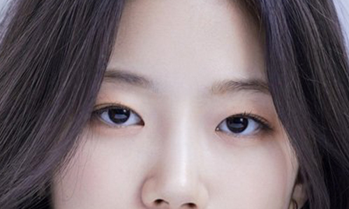 Let’s Take a Look at the Types of Double Eyelids. image 3