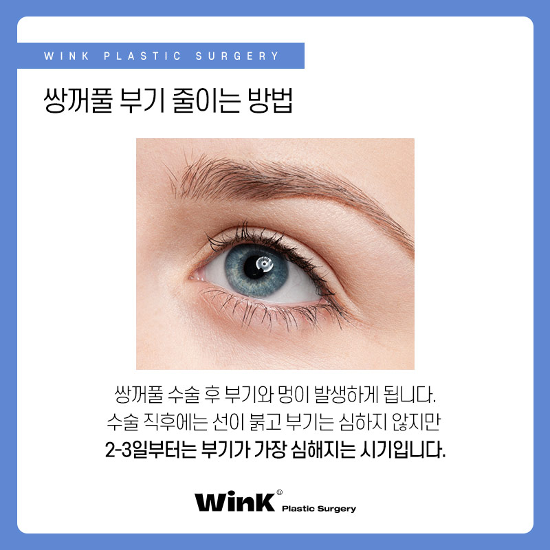 신사역쌍꺼풀수술 후 부기 빨리 빼고 싶다면? 눈수술후관리법 관련 이미지 2