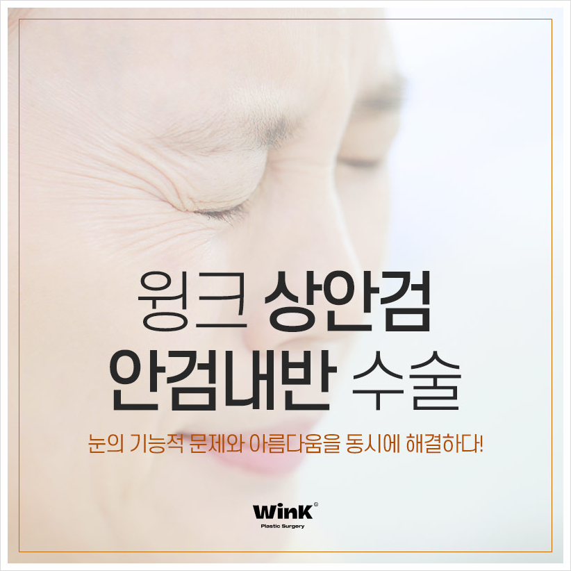 상안검안검내반 속눈썹찔림수술  윙크성형외과 안검내반수술후기 관련 이미지 1