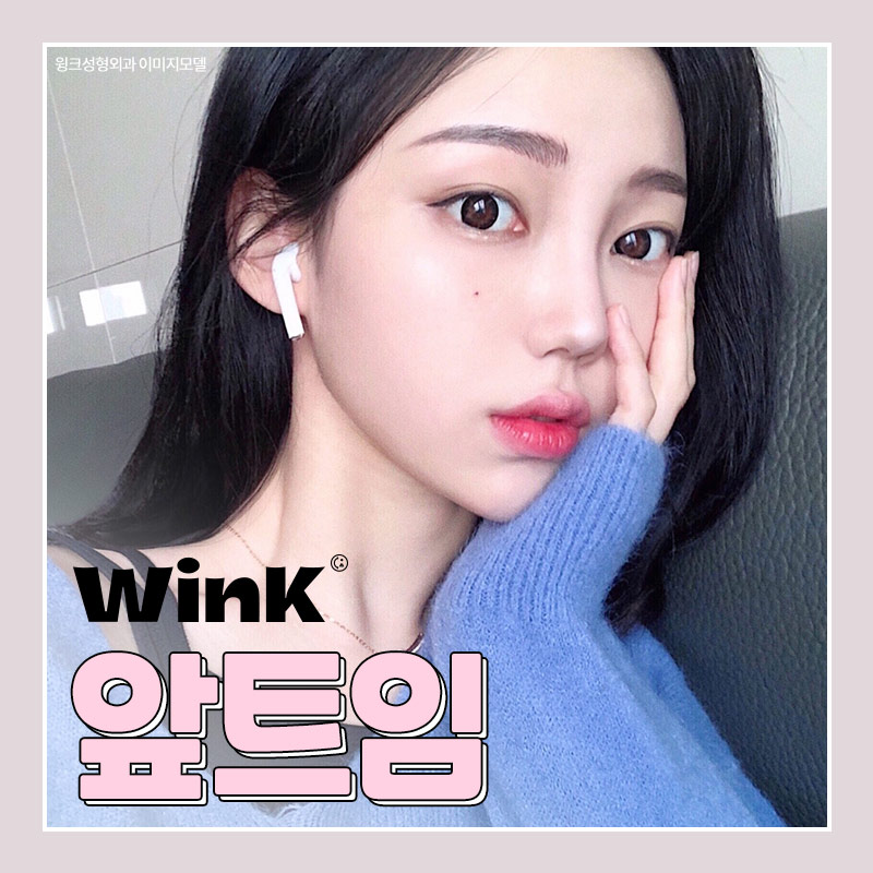 윙크 앞트임, 답답한 눈 앞머리를 시원하게 관련 이미지 4