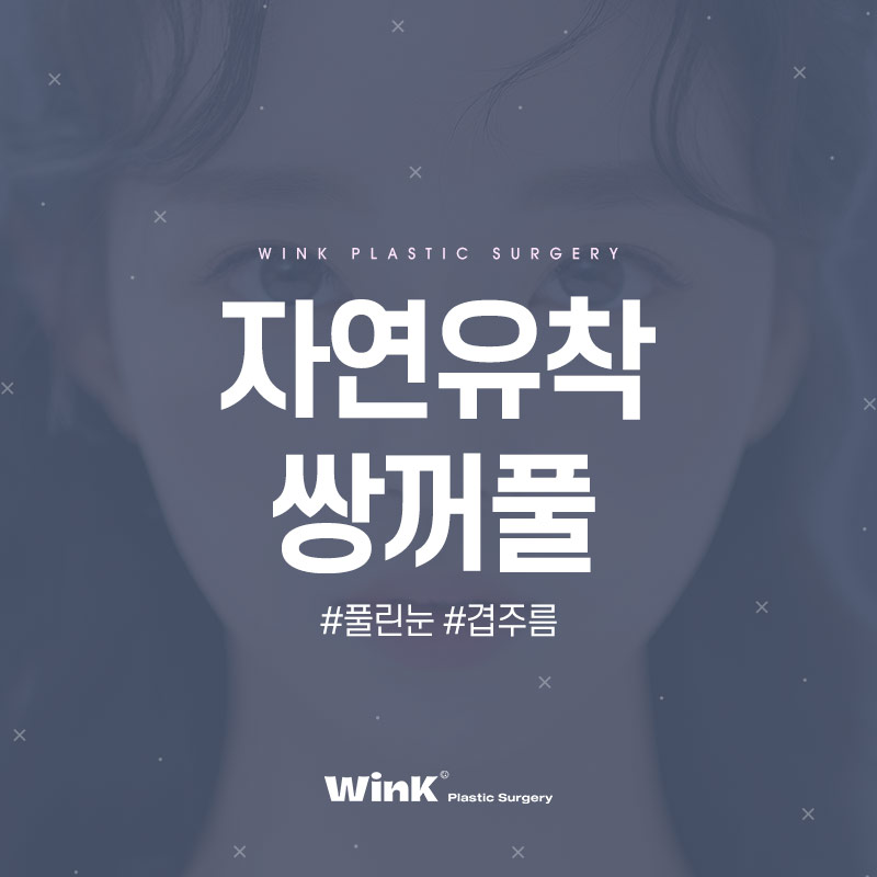 자연유착 쌍꺼풀수술로 겹주름을 해결하려면? 관련 이미지 1