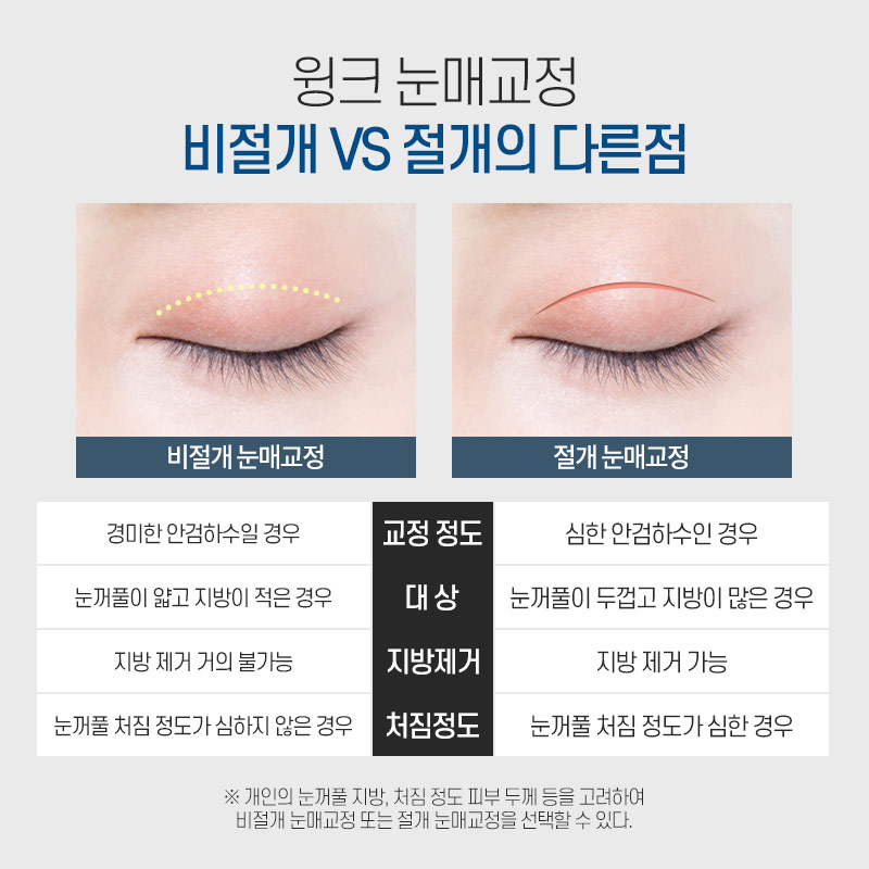 The Key to Ptosis Correction Is Proper Iris Exposure! image 4