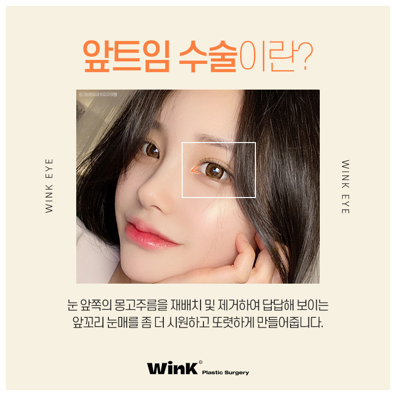 Feeling cramped at the inner corners of your eyes? Make them look refreshed with WINK Plastic Surgery epicanthoplasty! image 2
