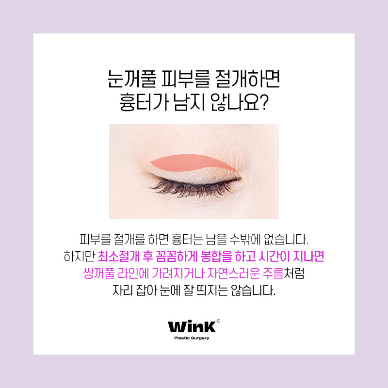 Improve Droopy Eyes with Wink Middle-Age Eyelid Surgery! image 2