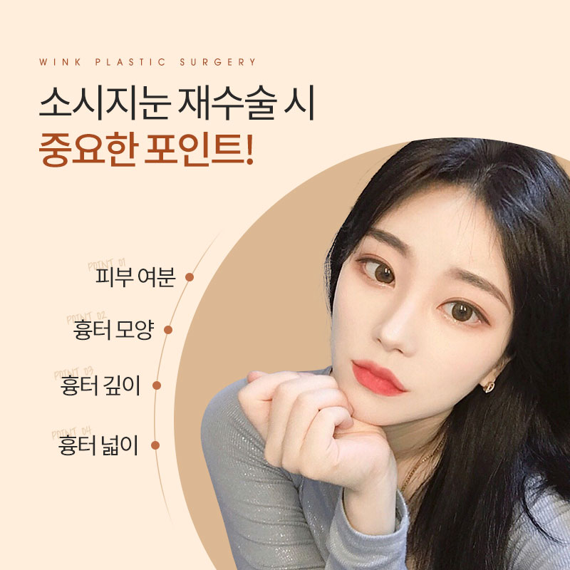 앞쪽이 두꺼운 아웃라인 쌍꺼풀, 해결 방법은? 관련 이미지 7
