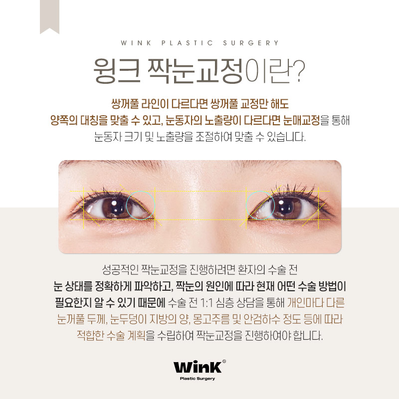 정확한 원인 파악과 적합한 수술 방법이 중요한 윙크성형외과 짝눈교정 관련 이미지 4