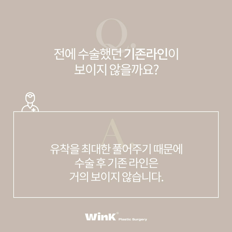 신사역쌍꺼풀재수술 알아본다면? 윙크성형외과 두줄따기눈재수술 관련 이미지 5