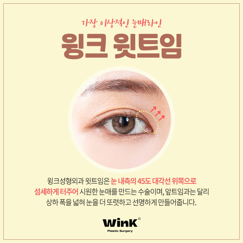 섬세하게 들어올려 또렷한 윙크윗트임 윗트임후기 윗트임잘하는곳 신사윗트임가격 관련 이미지 2