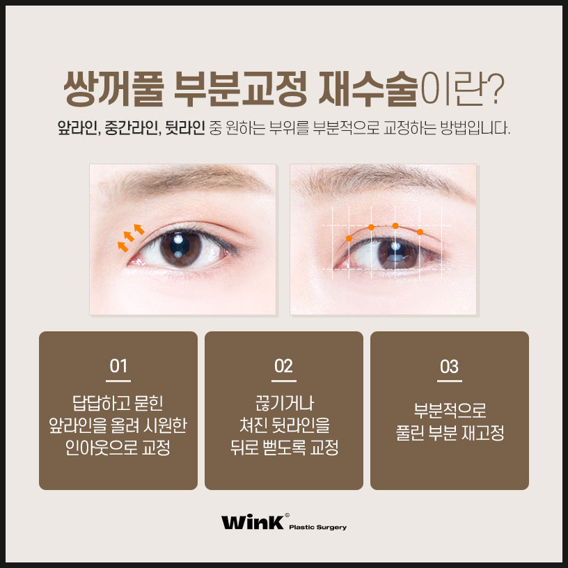 쌍꺼풀부분교정 쌍꺼풀부분절개수술 윙크성형외과 쌍수부분절개 신사쌍커풀수술 관련 이미지 3