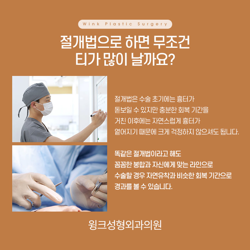 절개쌍꺼풀 절개재수술 흉터도 자연스럽고 깨끗하게! 관련 이미지 4