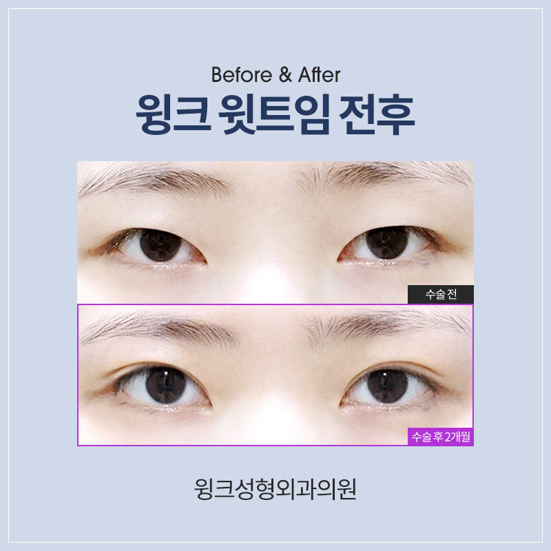 윗트임에 대해 알아보겠습니다. 관련 이미지 3