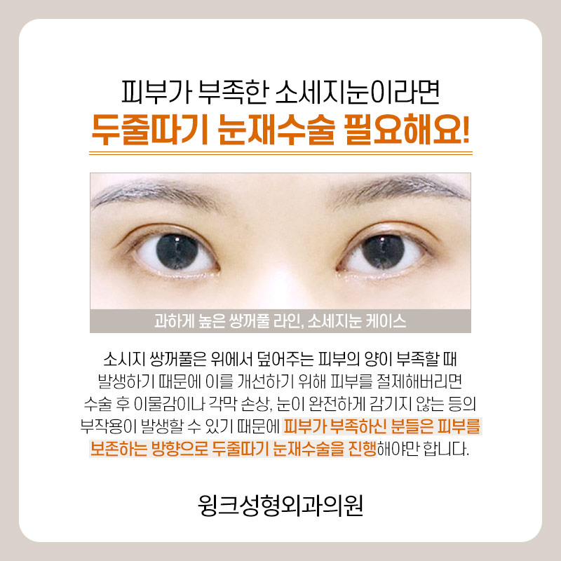 Let’s take a look at the differences before and after line lowering. image 4
