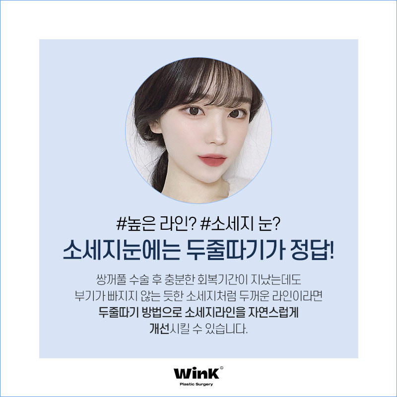 소세지눈? 윙크성형외과 두줄따기가 정답! 관련 이미지 2