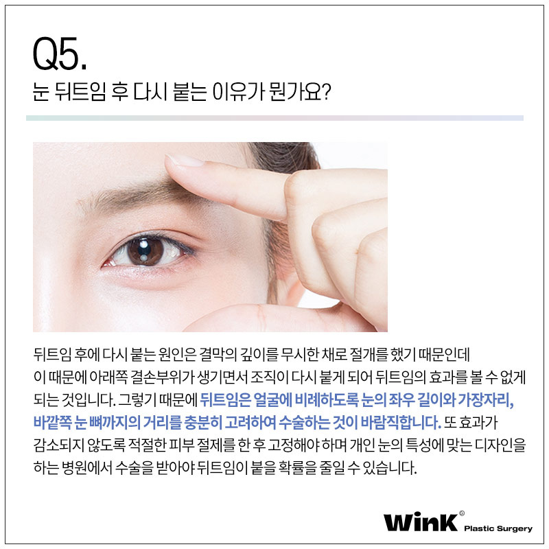 윙크성형외과에서 알려드리는 트임에 관한 모든 것! 관련 이미지 7
