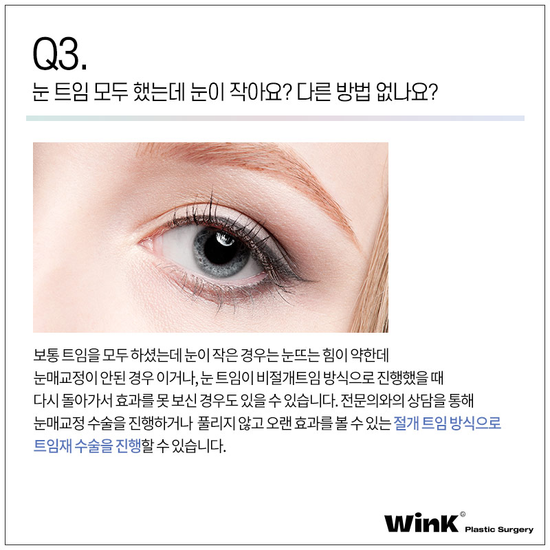 윙크성형외과에서 알려드리는 트임에 관한 모든 것! 관련 이미지 5