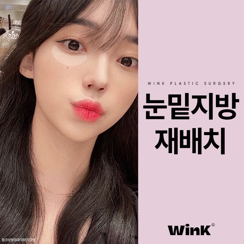 윙크성형외과 눈밑지방재배치로 생기 가득한 환한 눈밑으로 관련 이미지 6